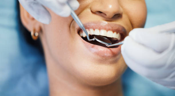 Best Emergency Dental Extractions in Green, OH