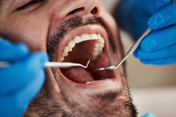 Best Emergency Dental Services for Seniors in Green, OH